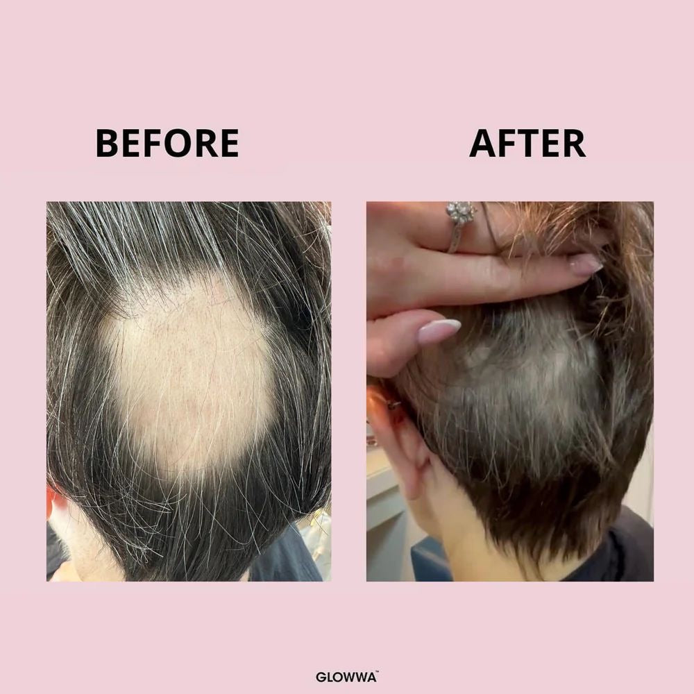 GLOWWA Hair Food [Original]