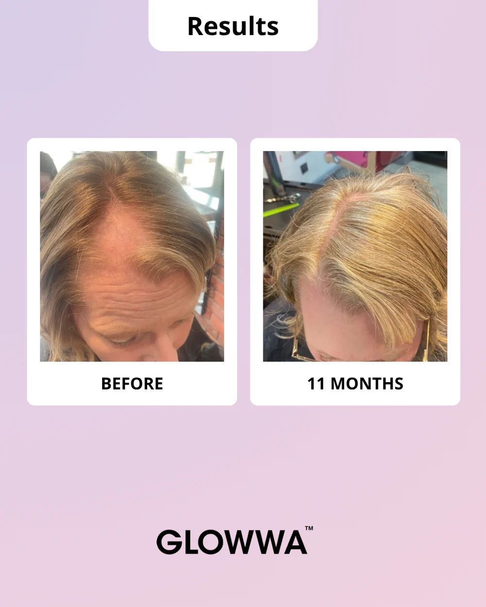 GLOWWA Hair Food [Meno]