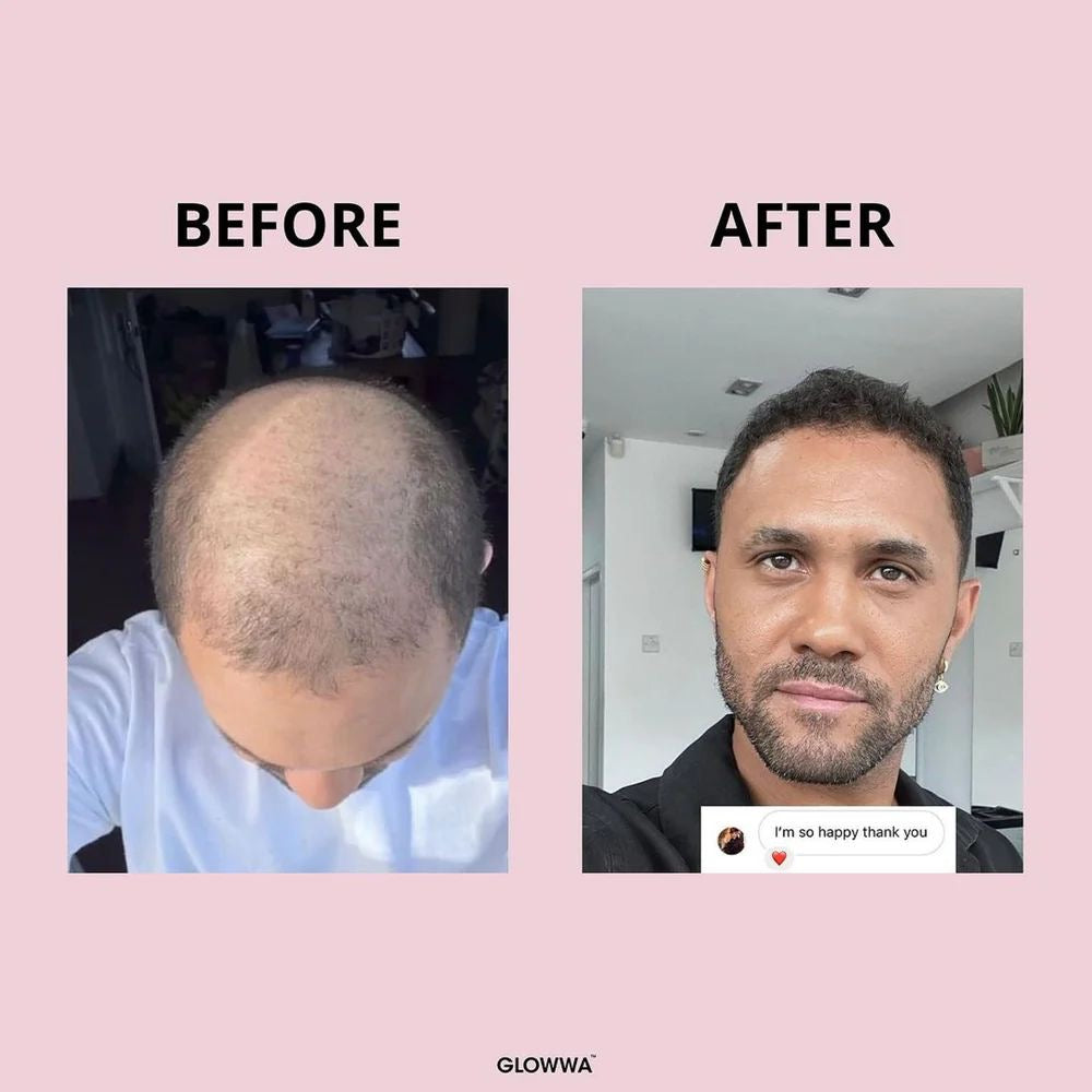 GLOWWA Hair Food [Original]